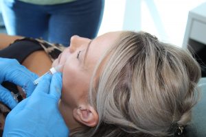 dermal fillers