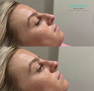 non surgical
