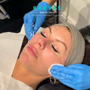 Chemical peels