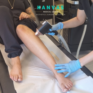 laser hair removal photo